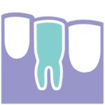 St. Johnsbury Dental Associates - Root Canal Treatment